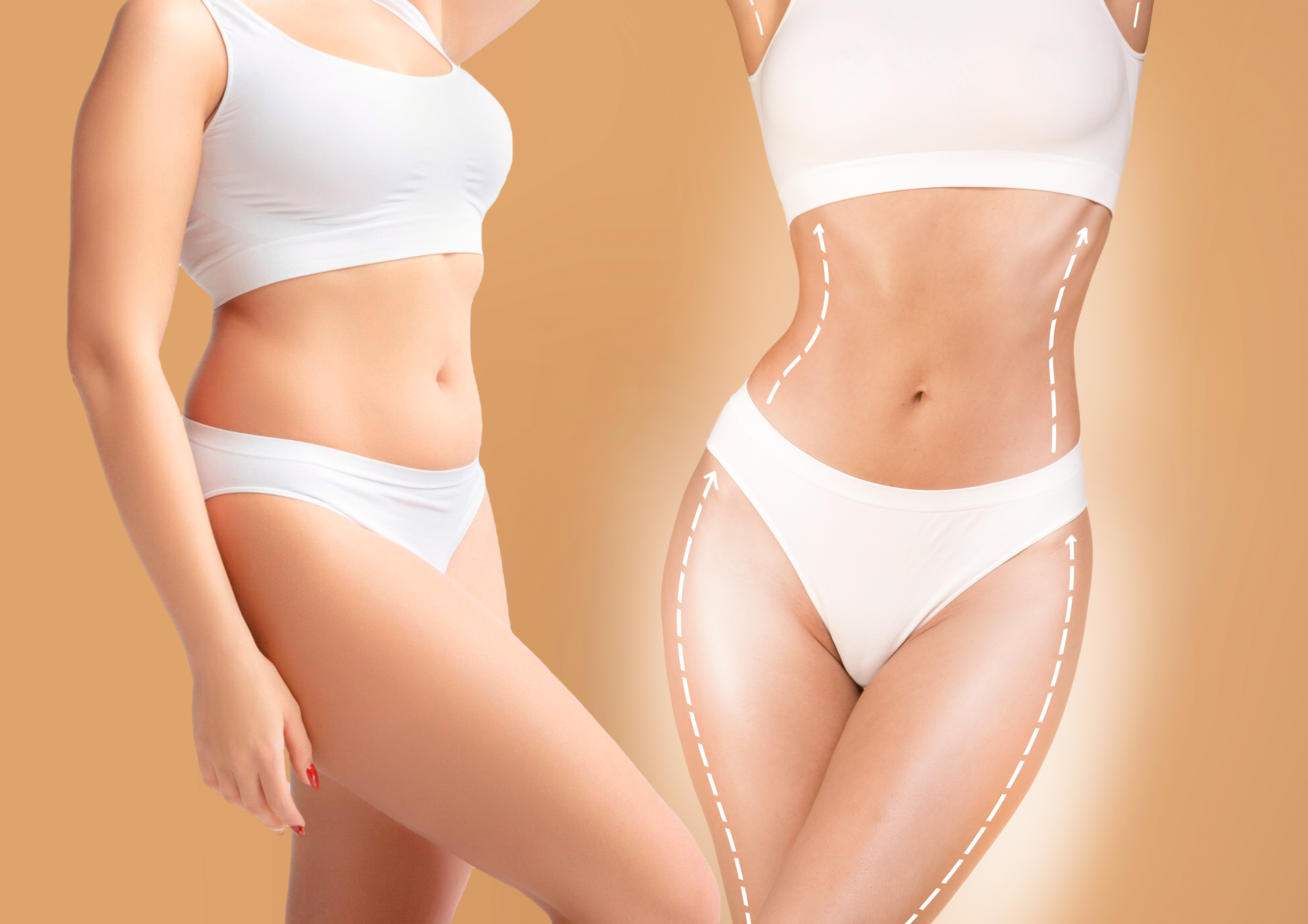Imagem de abdomen comparativo
